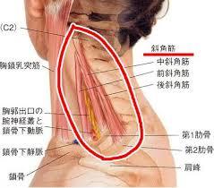 胸郭出口症候群